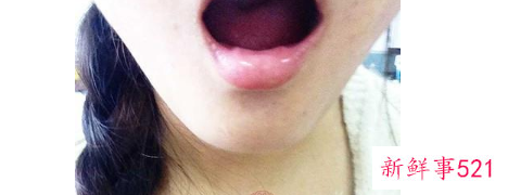 怎么调理湿气重的身体