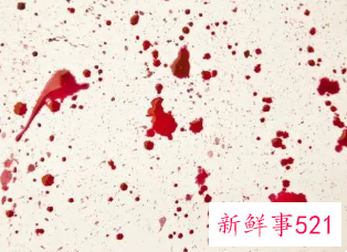 女人梦见血水是什么预兆