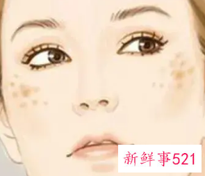 晒斑和黄褐斑的区别在哪里