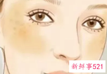 晒斑和黄褐斑的区别在哪里