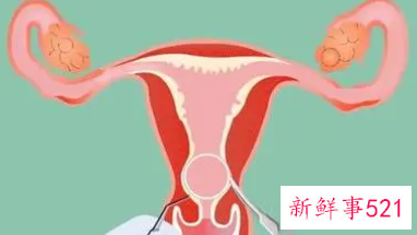 女人什么时候上环最好