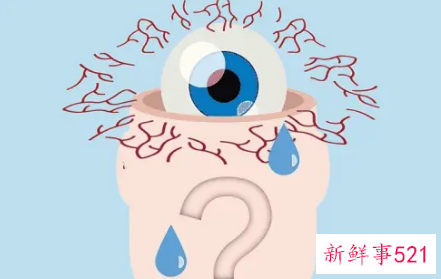 眼睛干涩是什么原因引起