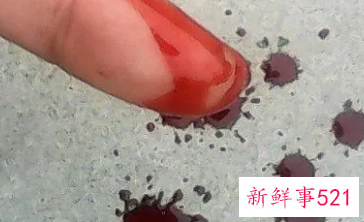 梦见脓血有什么征兆