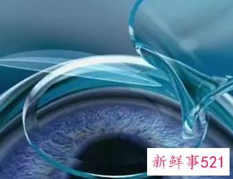 做近视手术有风险和后遗症的吗