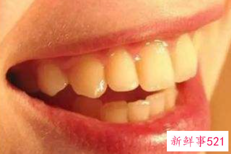 牙齿黄该怎么解决