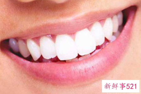 牙齿黄该怎么解决
