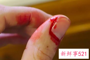 梦见脓血有什么征兆