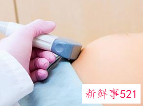 胎动非常厉害怎么回事