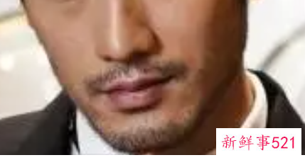 男士胡须彻底脱毛大约多少钱