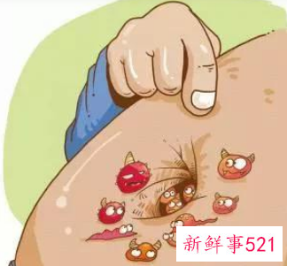 为什么脐炎反复发作