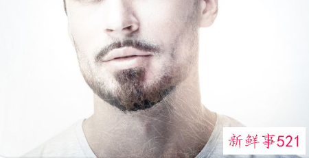 男士胡须彻底脱毛大约多少钱