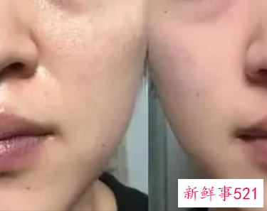 皮肤怎么变细腻