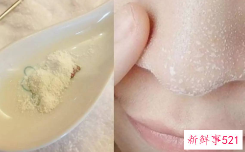 轻松去黑头的5个独门秘方