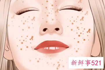 脸颊两侧长斑怎么办