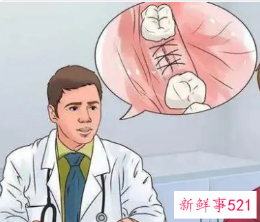 局麻对大脑有影响吗