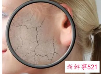 解决面部干燥的五妙招
