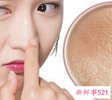 毛孔的几大杀手