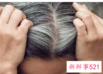 头发少的人真的有福吗