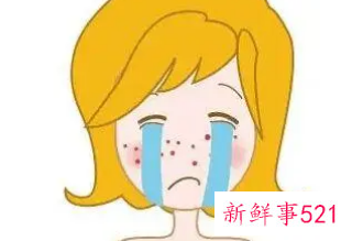 女孩长青春痘怎么办