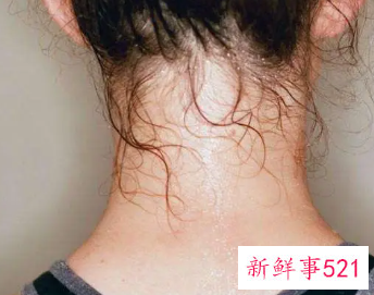 出汗特别多什么原因