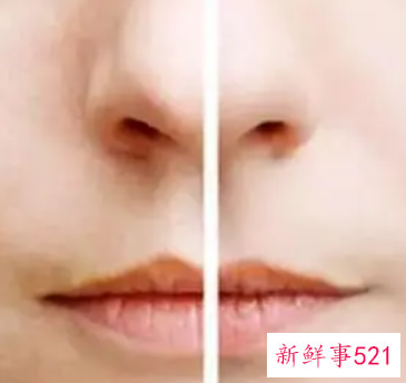 毛孔的几大杀手