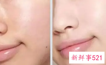 怎么提升皮肤亮度