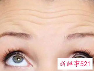 淡化额头皱纹的办法