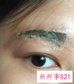 做完眉毛涂抹生理盐水