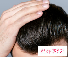 头发少的人真的有福吗