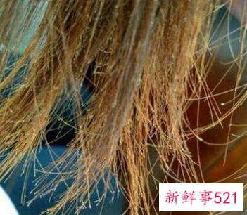 头发烫坏了像枯草怎么办