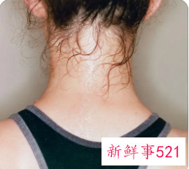 出汗多女性是什么原因