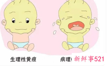 宝宝有黄疸手却很白