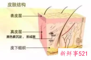 真皮斑能自愈吗
