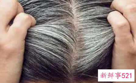 几个食疗偏方摆脱白发