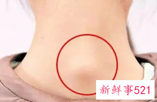 富贵包有什么危害和影响