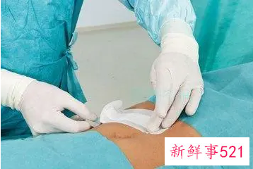 手术后怎么恢复最快