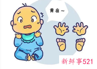 宝宝有黄疸手却很白