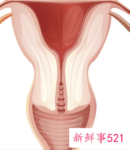 子宫下垂是什么原因引起的