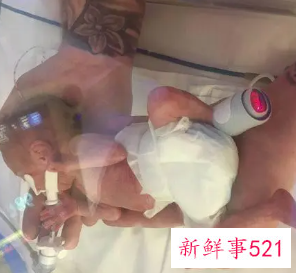 六个月早产儿费用多少