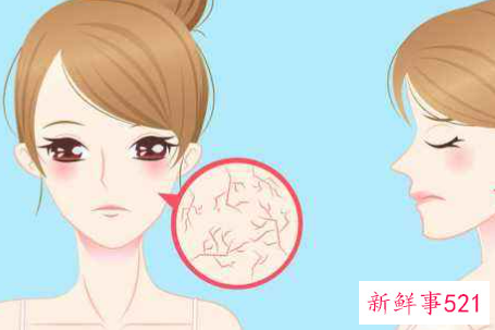 皮肤松弛需谨慎