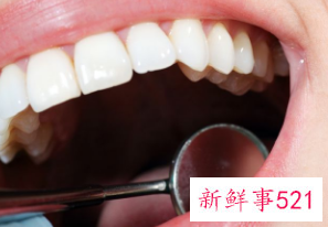 如何去口气异味小妙招