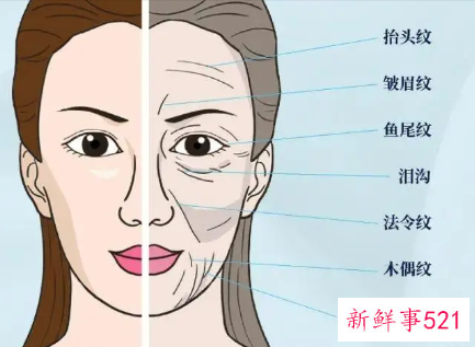 运动法令纹会消除吗