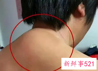 富贵包有什么危害和影响