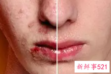 男人如何保护肌肤