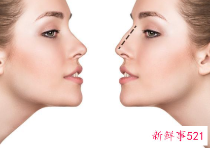 做完医美项目什么时候能化妆