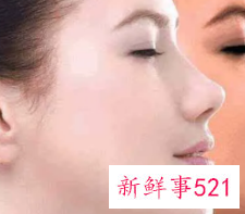 皮肤晒后变黄是为什么