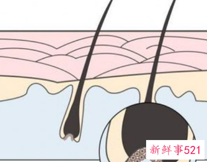 hbw毛囊克隆植发