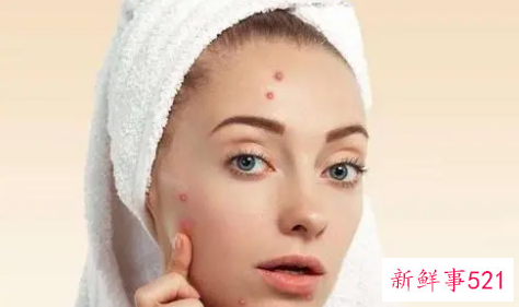 怎么才能让脸上皮肤没有油