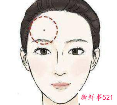 身上哪些痣有可能癌变