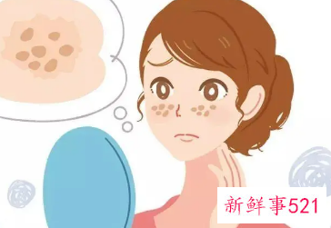 被太阳晒出黑斑怎么办